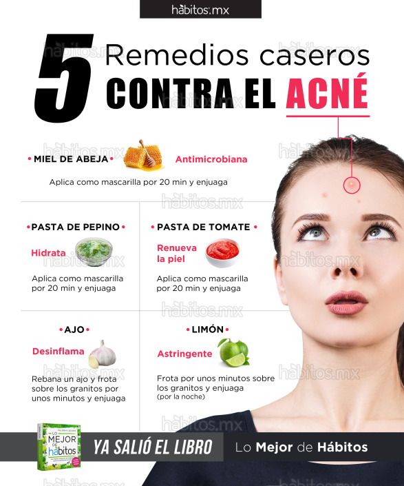 Acné: Remedios naturales para una piel sana