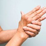 Artritis Psoriásica y Síndrome de Raynaud: Conexión y Tratamiento