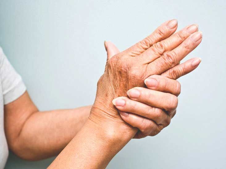 Artritis Psoriásica y Síndrome de Raynaud: Conexión y Tratamiento