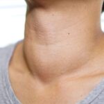 Bulto en el cuello: ¿infección, tumor o qué?