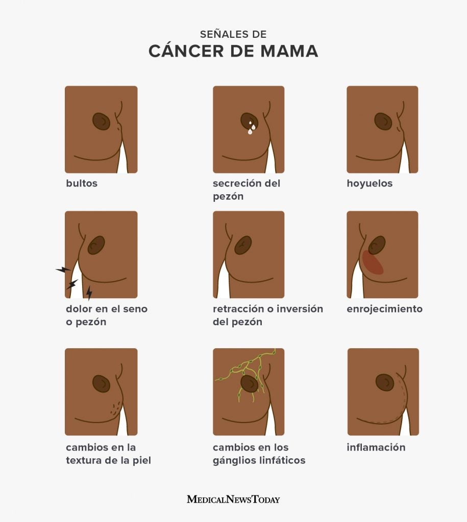 Bultos Mamarios: Causas, Tipos y Diagnóstico