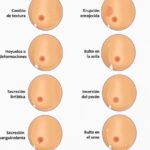 Bultos Mamarios: Detección Temprana y Diagnóstico