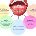 Cáncer de Lengua: Síntomas, Etapas y Riesgo