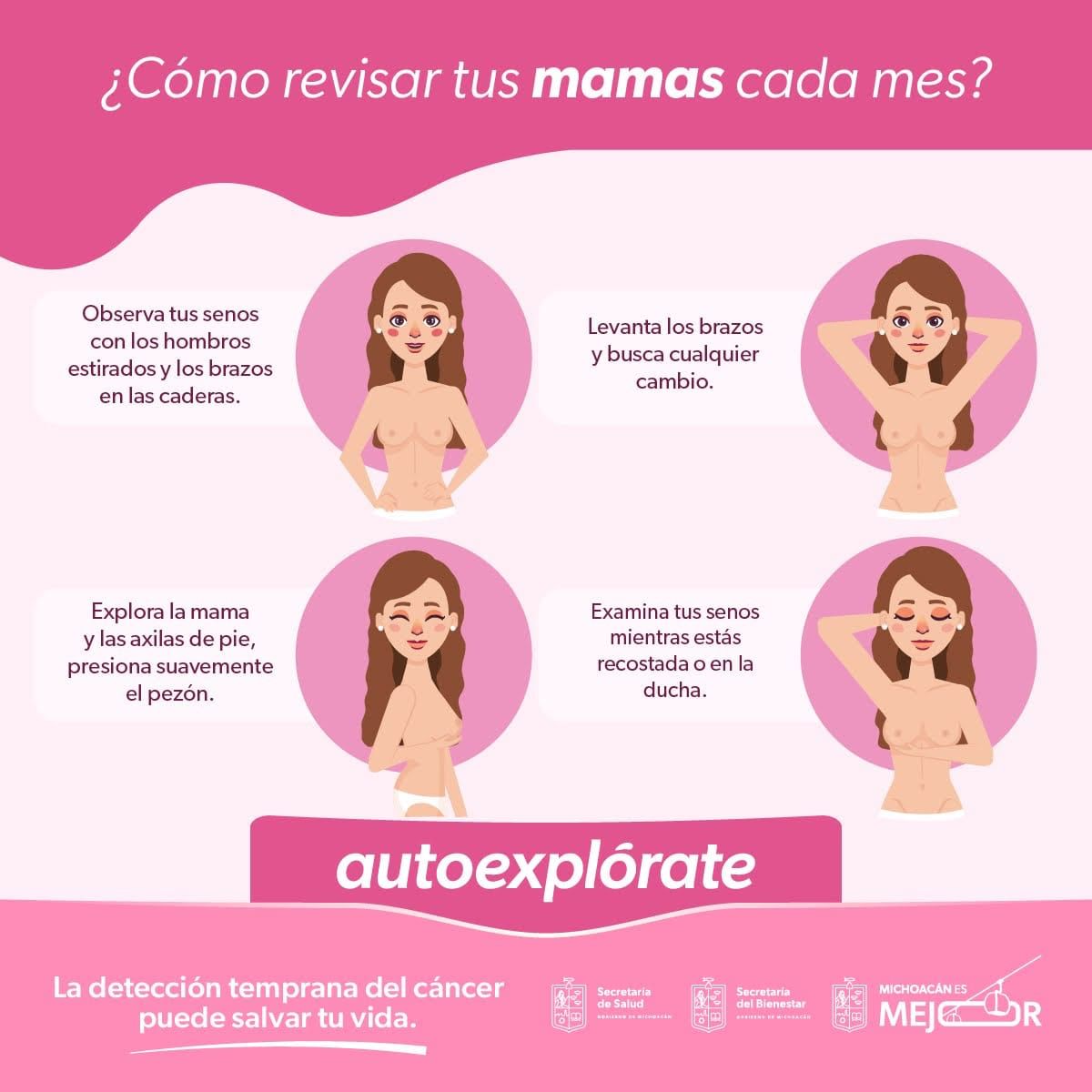 Cáncer de Mama: Síntomas, Detección Temprana y Claves
