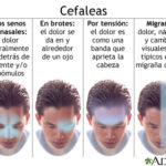 Cefalea: Dolor de cabeza, causas y cuándo consultar