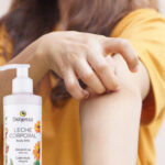 Dermatitis Atópica: Alivio Natural para Pieles Sensibles