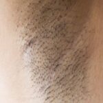 Dolor Axilar: Causas y Posibles Enfermedades