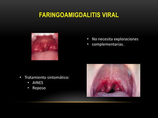 Dolor de garganta unilateral: ¿Qué puede ser?