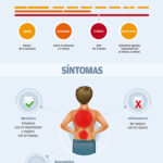 Dolor Lumbar: Causas, Tipos y Duración