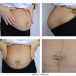 Embarazo gemelar: Piel radiante, ¡sin estrías!