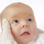 Erupciones faciales en bebés: causas y tratamiento