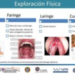 Goteo Postnasal: Causas, Síntomas y Riesgos