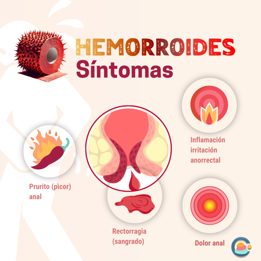 Hemorroides: Síntomas, Sangrado y Cuándo Consultar
