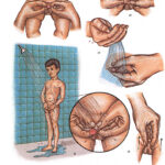 Higiene del prepucio: cuidado e importancia en hombres no circuncidados