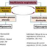 Hipercapnia: Síntomas, causas y tratamientos