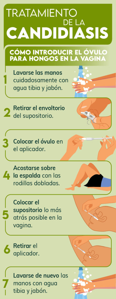 Infecciones vaginales por hongos: Guía de tratamientos