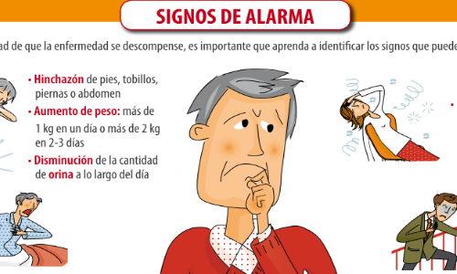 Insuficiencia Cardíaca: Síntomas y Alerta Médica