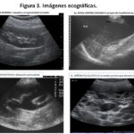 Insuficiencia Renal: Diagnóstico por Imágenes y Análisis