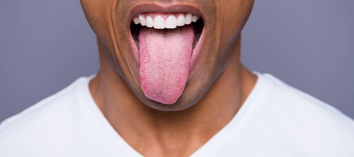 Lengua Blanca: ¿Inofensiva o señal de alerta?