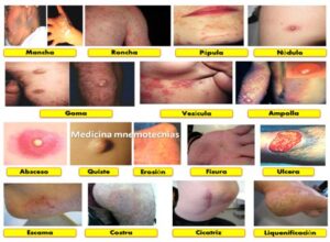 Lesiones Cutáneas: Guía de Causas y Tipos - Blog naturabeauty