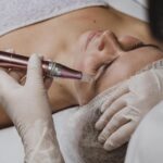 Microneedling: Piel renovada, cuidados post-tratamiento