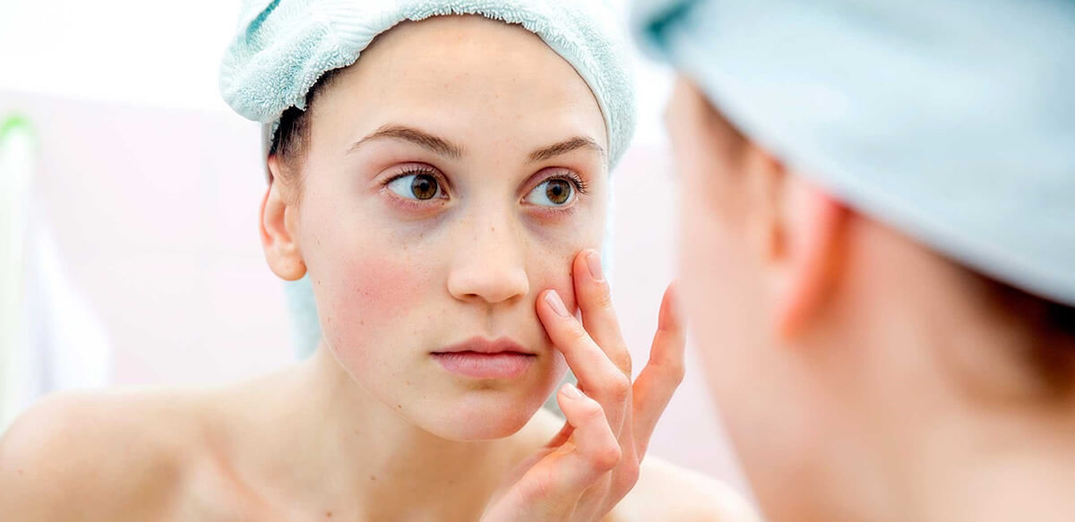 Ojeras: Causas, remedios y soluciones