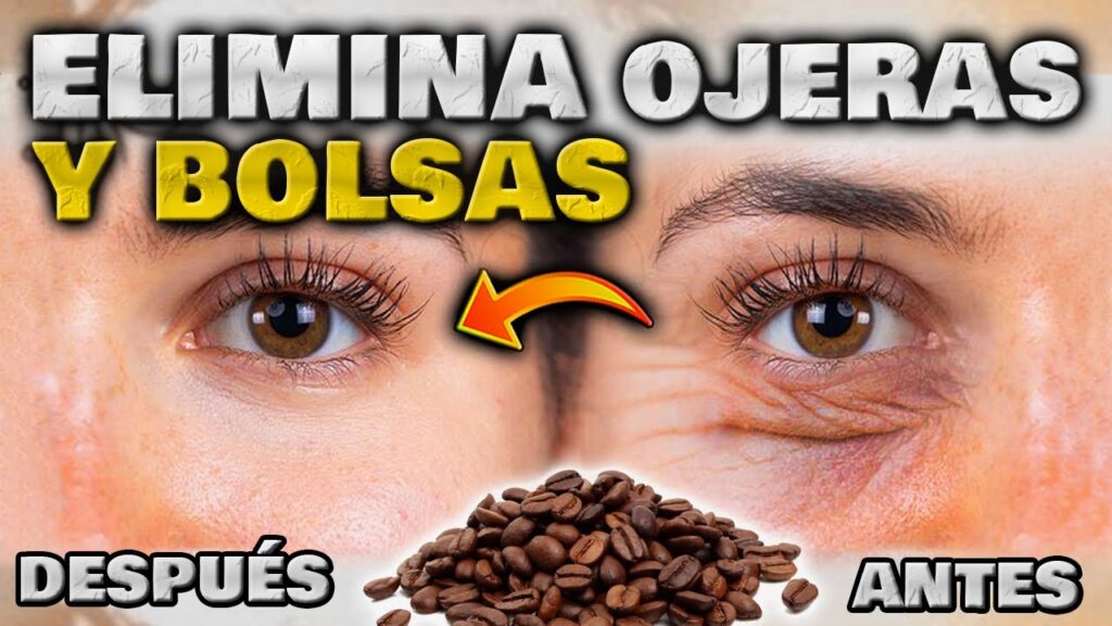 Ojeras: Remedios rápidos y tratamientos efectivos
