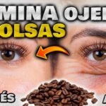 Ojeras: Remedios rápidos y tratamientos efectivos