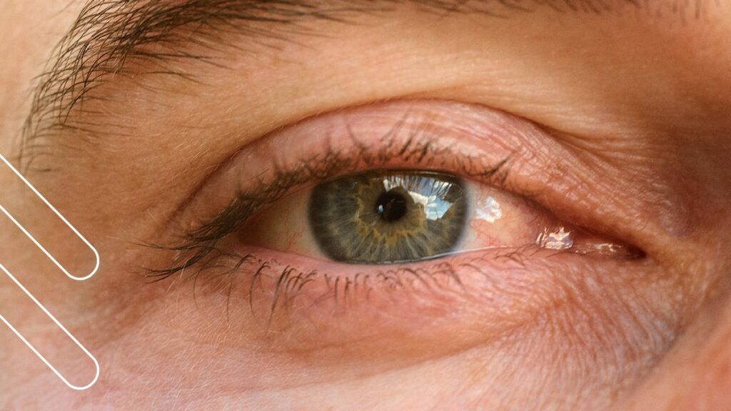 Ojos Secos: Un Síntoma Oculto de la COVID-19