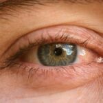 Ojos Secos: Un Síntoma Oculto de la COVID-19