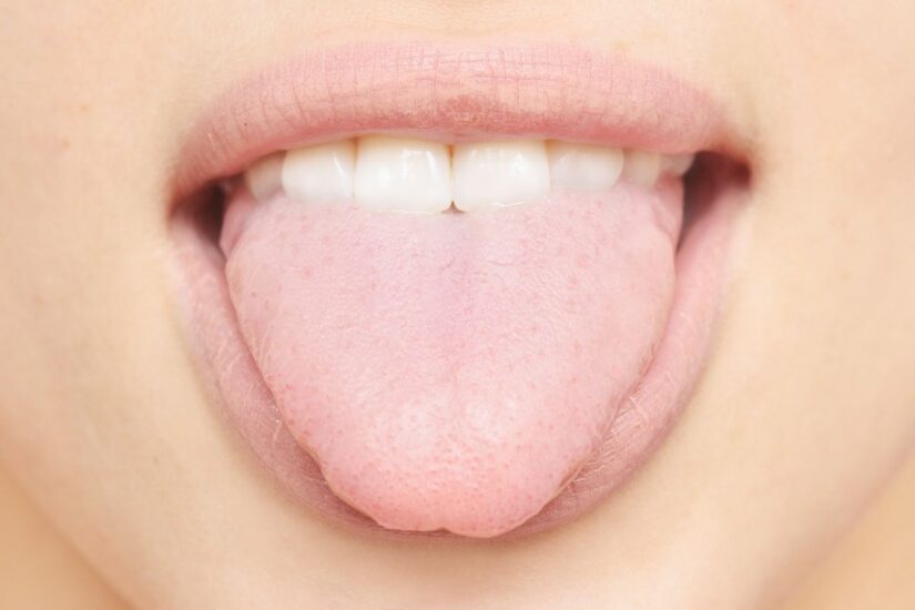 Protuberancias en la lengua: causas y cuándo consultar