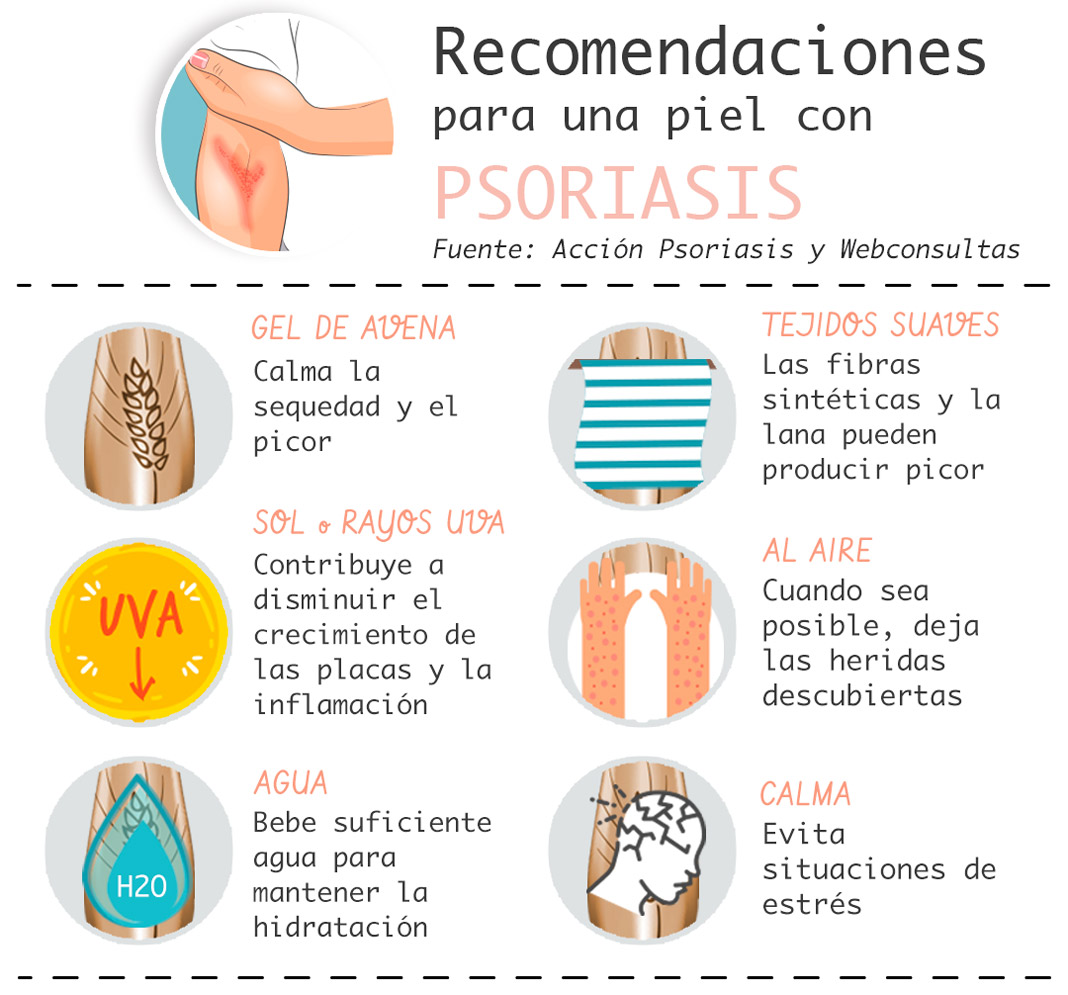 Psoriasis: Síntomas, Tipos y Tratamiento Efectivo