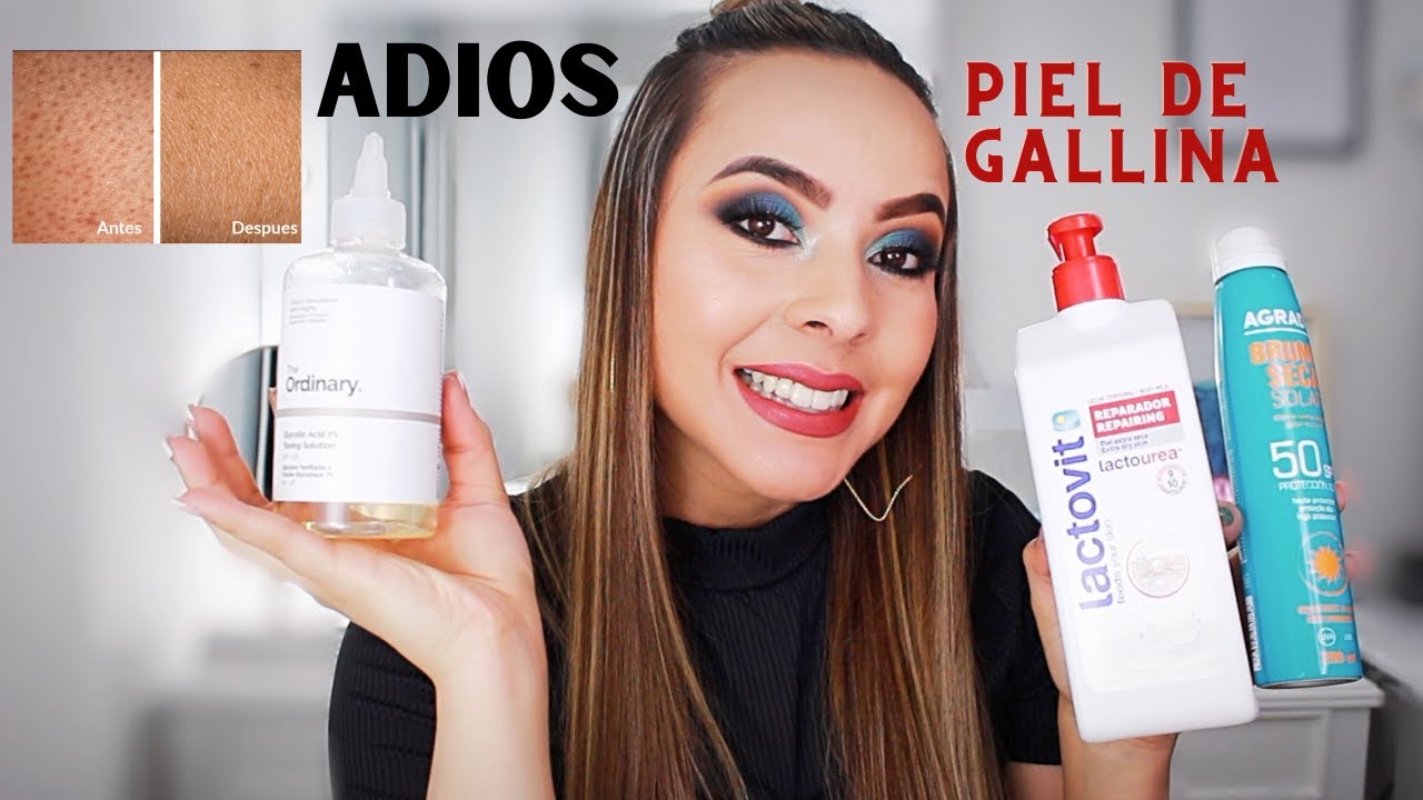 Queratosis Pilar: Adiós a la «piel de gallina»
