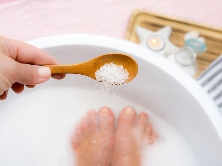Sales de Epsom y Psoriasis: Alivio y Precauciones