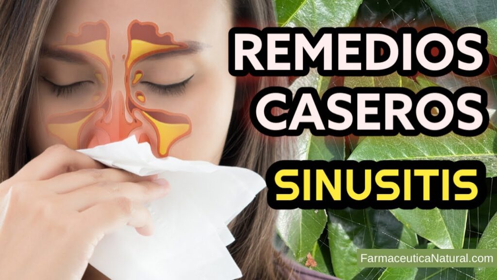 Sinusitis: Remedios para el alivio sinusal