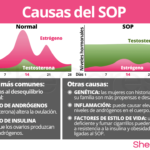 SOP: Desequilibrio Hormonal y sus Consecuencias