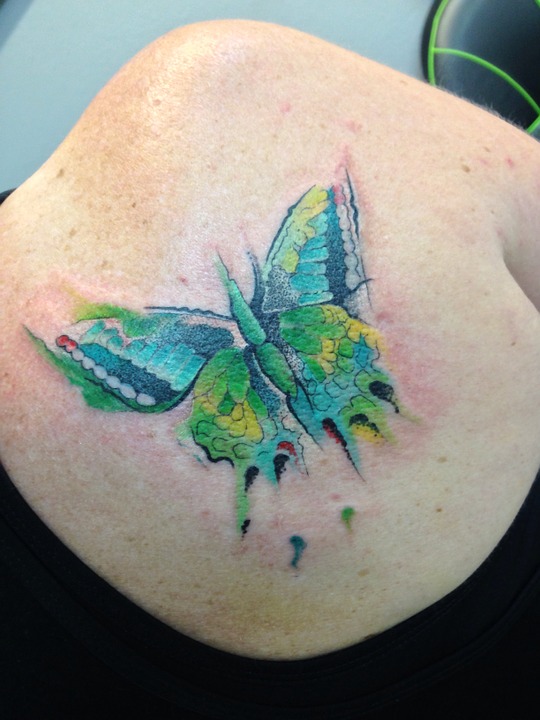 Tatuajes: Belleza con Riesgos de Infección