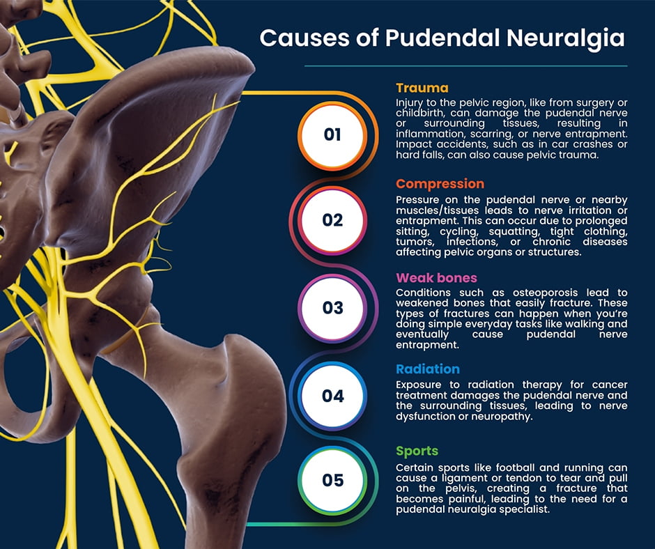 Tratamiento Definitivo Neuralgia Pudenda: Médicos Expertos