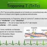 Troponina: clave para detectar daño cardíaco